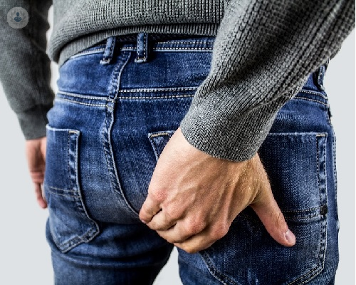 hemorroides-internas-y-externas