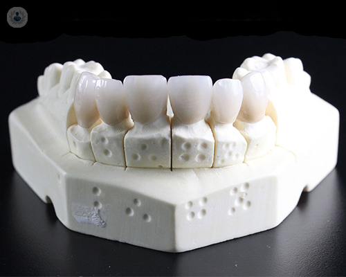 estetica-dental-algo-mas-que-blanqueamientos