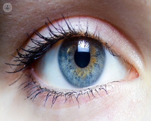 Agujero macular: qué es, causas y síntomas 