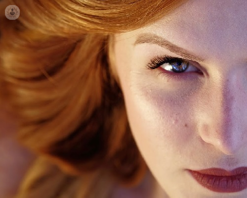 blefaroplastia-inferior-como-acabar-con-las-bolsas-en-los-ojos imagen de artículo