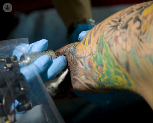eliminar-tatuajes-con-laser imagen de artículo