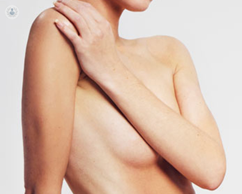 Prótesis anatómicas de alto perfil para mamas tuberosas