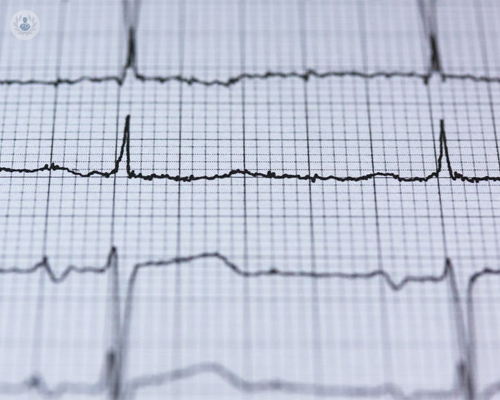 cardiodiagnosis-creu-blanca