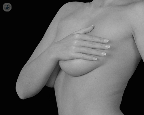 “Las mamas tubulares tienen como única solución la cirugía. El resultado vale la pena”