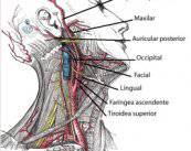 cirugia-carotida