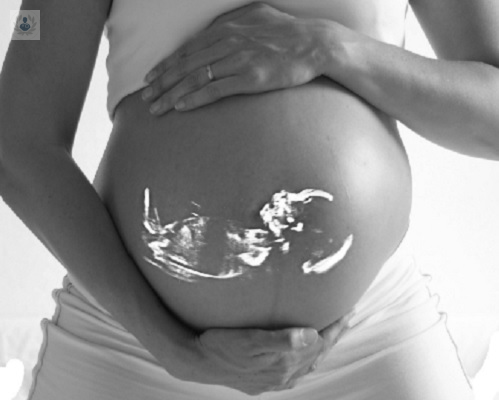 Amniocentesis, cuándo se realiza y qué riesgos tiene