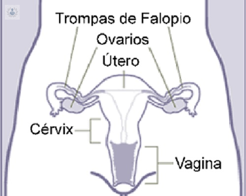 Quiste de ovario, un problema potencialmente peligroso