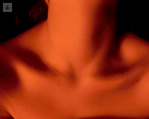 bocio-glandula-tiroides