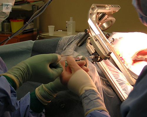 laser-verde-prostata