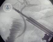 endoscopia-craneal