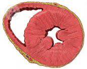 “La raíz aórtica es la porción más proximal a la principal arteria del cuerpo, la aorta”