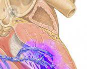 valvula-cardiaca-cirugia