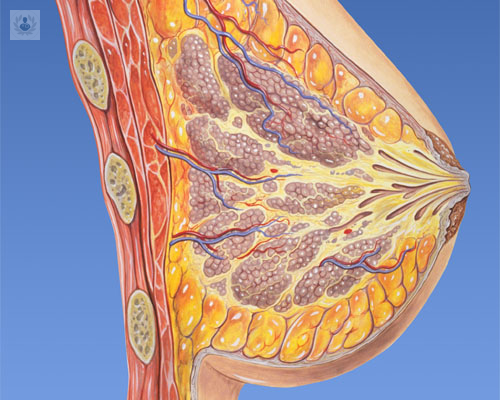 protesis-implantes-mamarios