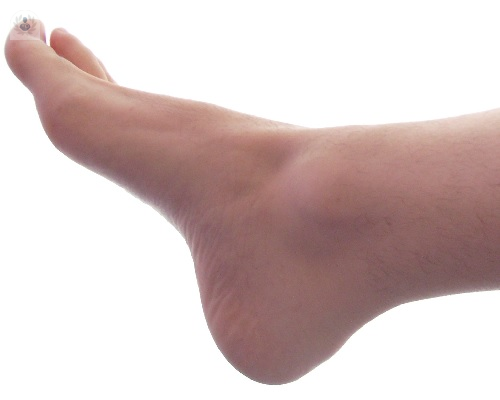 tendon-aquiles-1