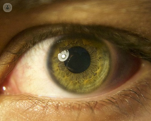 Guía del desprendimiento de retina