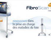 FibroScan, la biopsia hepática virtual