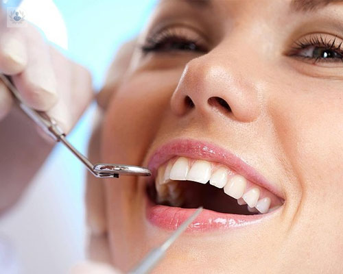 ¿Cómo conseguir una buena estética dental?