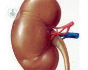El procedimiento convencional del trasplante renal