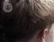 trastorno-limite-borderline