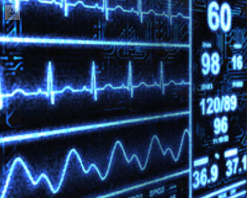 isquemia-aguda-infarto-de-miocardio