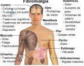 sindrome-de-sensibilidad-central