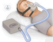 apnea-del-sueno-cpap