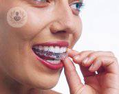 implante-dental-en-un-adulto