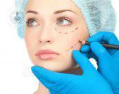 ¿Qué son los rellenos o implantes faciales? 