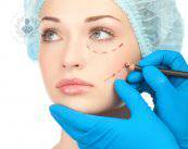 rellenos-o-implantes-faciales