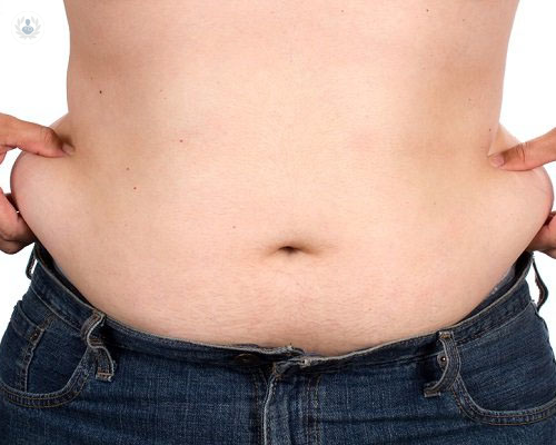 el-bypass-gastroileal-una-tecnica-eficaz-para-combatir-la-obesidad imagen de artículo