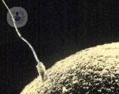 causas-infertilidad-masculina