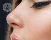 endoscopia-nariz