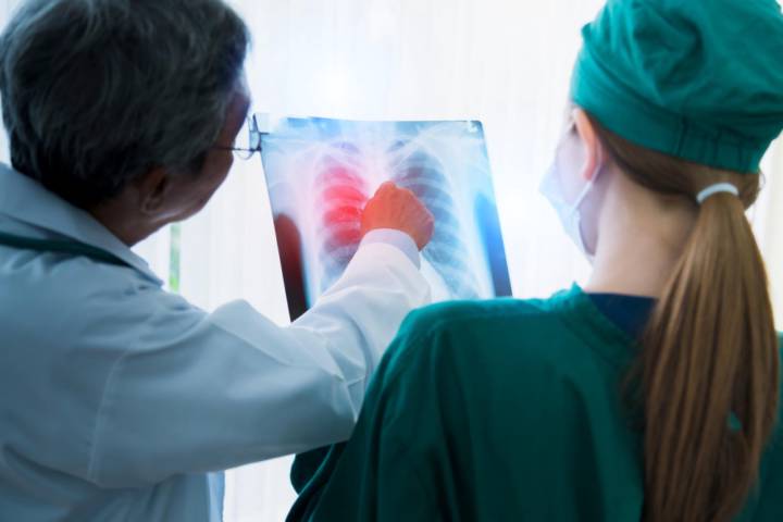 fibrosis-pulmonar-diagnostico-precoz-tratamientos-avanzados-cuidar-respiracion imagen de artículo