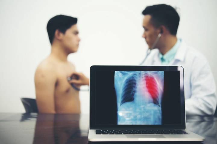 nodulo-pulmonar-entenderlo-tiempo-puede-salvar-vidas imagen de artículo