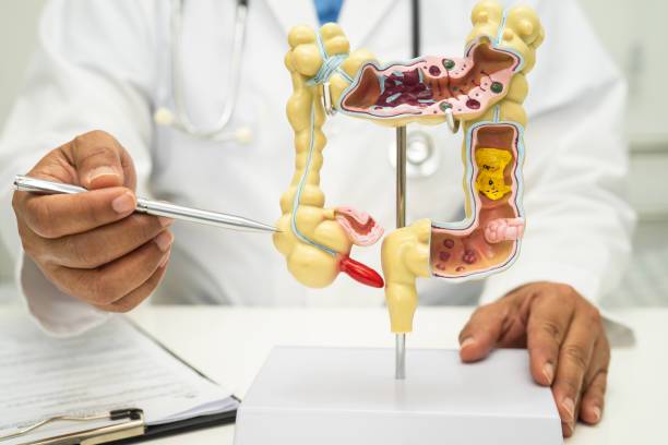 cancer-colorrectal-deteccion-sintomas-y-tratamiento imagen de artículo