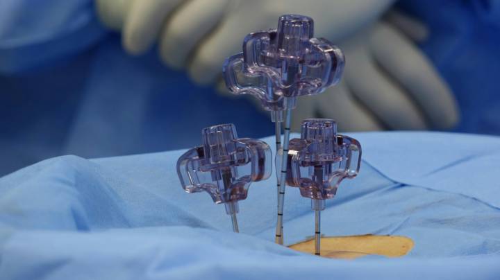 cirugia-columna-minimamente-invasiva-neurocirugia imagen de artículo