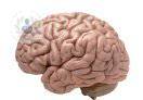 infartos-en-el-cerebro
