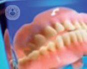 implantes-cigomaticos