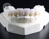Elimina tu miedo al dentista: prótesis dentales novedosas y seguras