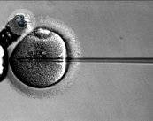 La inseminación artificial, la técnica de reproducción asistida más antigua