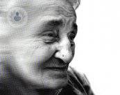 alzheimer-mujer