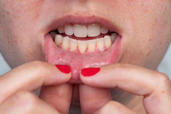 el-envejecimiento-es-inevitable-la-perdida-de-dientes-no imagen de artículo