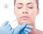 botox-en-la-cara