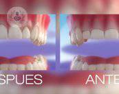 Los procedimientos periodontales estéticos pueden mejorar su sonrisa