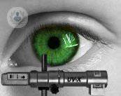 crosslinking-corneal