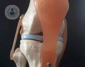 Así funciona la cirugía de artrosis de rodilla