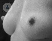 riesgos-mastopexia-mamoplastia