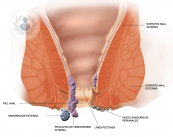 partes-hemorroides