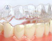 Retenedores dentales, imprescindibles tras una ortodoncia invisible