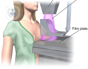 Differences between ultrasound and mammography